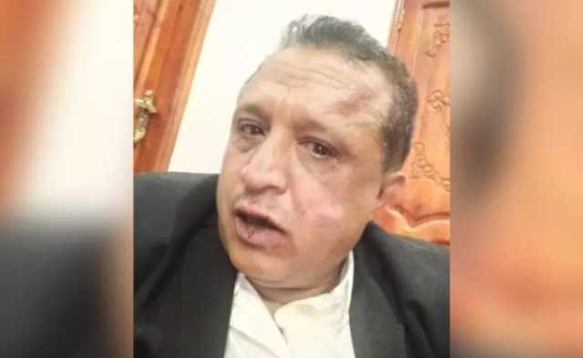 شاهد تعليق لنقابة الصحفيين اليمنيين بشأن حادثة الاعتداء الحوثي على الصحفي 'الصمدي '