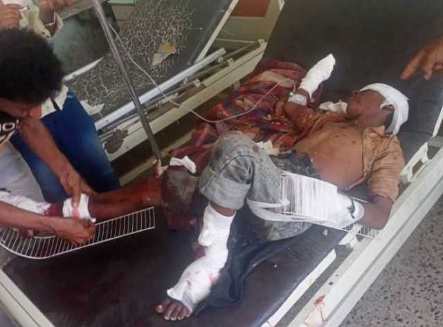 شاهد بالصورة كيف فعل لغم حوثي بالطفل (عدنان) الذي يسكن بقرية موبوءة بالالغام