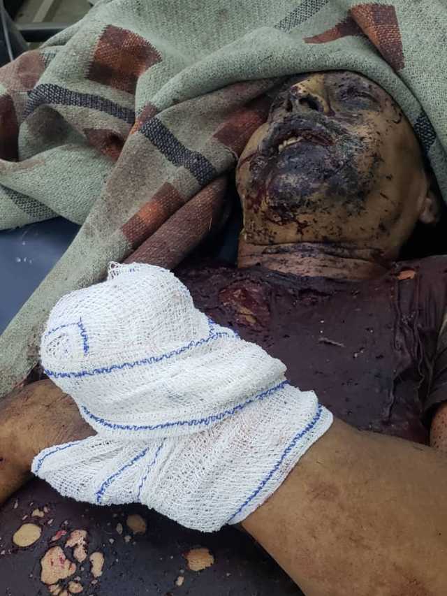 مجزرة أرهابية في الحديدة بادوات حوثية