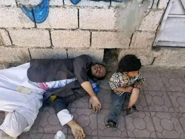 مشهد حزين لوفاة مواطن في إب جوعًا وقهراً