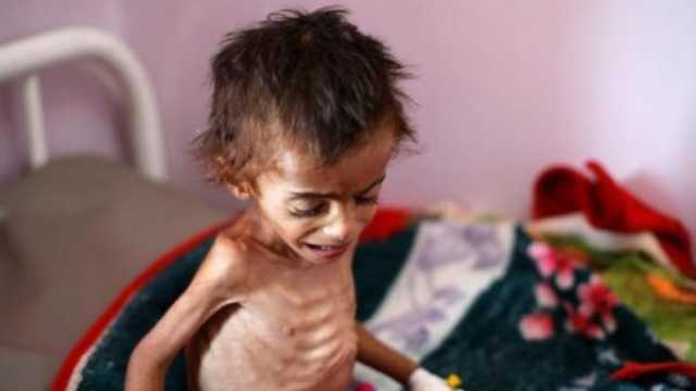 أمريكيا توقف المساعدات الطارئة عن اليمن ودول أخرى