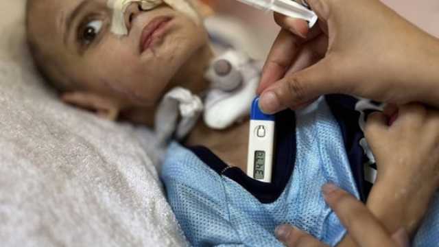 سوء تغذية.. 112 طفلا فلسطينيا يدخلون مستشفيات غزة يوميا