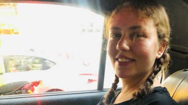 لماذا أصيبت الممثلة المصرية رحمة حسن بمرض الثعلبة البقعية؟