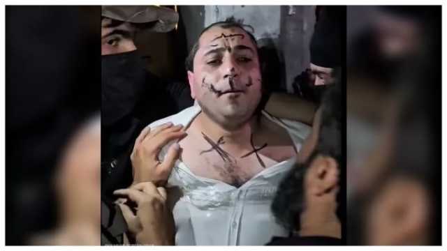 الاعتداء على فنان سوري والكتابة على وجهه بذل