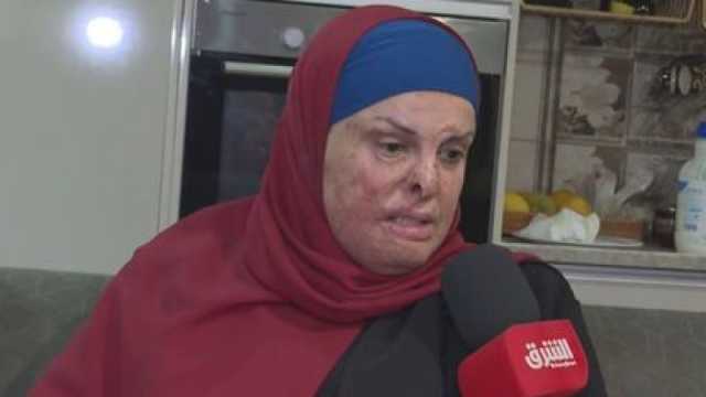 الاسيرة المحررة اسراء جعابيص تتحدّى بتر أصابعها وحرقها وتصدر كتابها الاول موجوعة