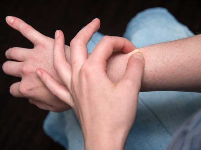 ‫كيفية العناية السليمة بالندبات