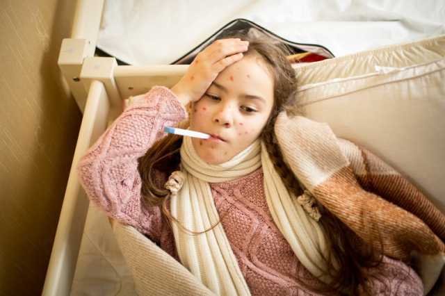 منظمة الصحة تحذّر من عودة كبيرة للحصبة في أوروبا