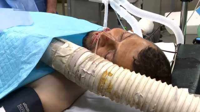 أول تعليق لمراسل الجزيرة إسماعيل أبو عمر بعد بتر قدمه: صواريخ الاحتلال لن تخيفنا