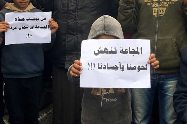 أطفال غزة.. آثار صحية كارثية للمجاعة وسوء التغذية