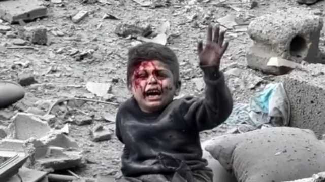 طفل مصاب يستغيث وسط ركام الموت في غزة