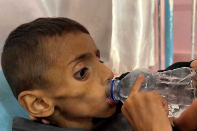 لوتان: غزة أصبحت مقبرة للأطفال بسبب القصف والتجويع