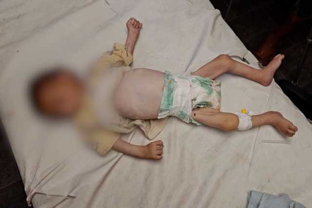 أمنستي: تجويع غزة سياسة إسرائيلية ممنهجة وجريمة حرب تتطلب تحركا دوليا عاجلا