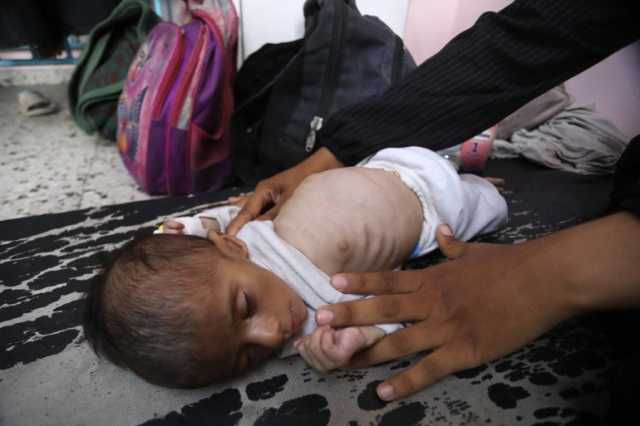 115 شهيدا.. التجويع يواصل الفتك بالفلسطينيين في غزة