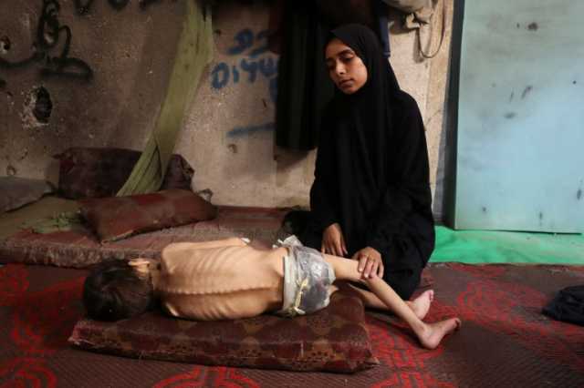 غزاوي بلندن: أعيش جحيما فثلاجتي ممتلئة وأمي مُجوَّعة وأختي تطعم أطفالها الحشائش
