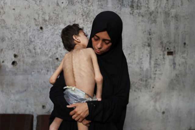 جدعون ليفي: صور المجاعة في غزة تذكر بالهولوكوست ومعسكرات الاعتقال