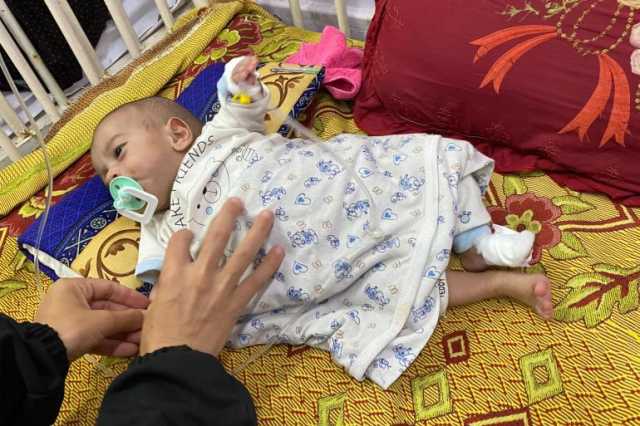 الأونروا: كل سكان غزة باتوا مجوعين و200 ألف طفل بمراحل الخطر