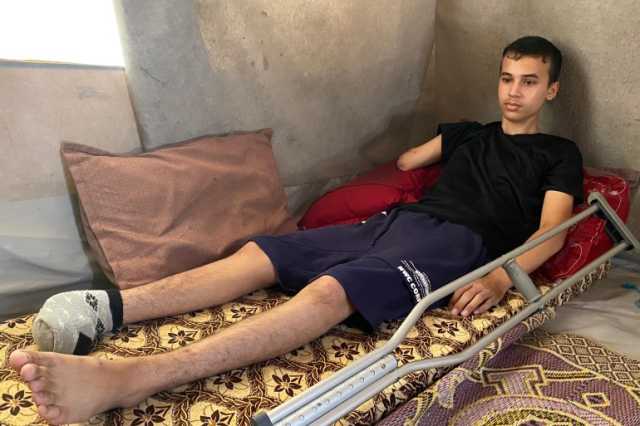 حرمه احتراف كرة القدم.. صاروخ إسرائيلي يبتر أطراف طفل من غزة