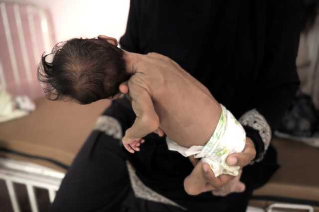 وفيات أطفال غزة كل ساعة وحصيلة ضحايا التجويع ترتفع