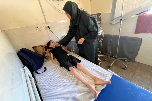 التجويع في غزة ينهش جسد الطفلة المريضة سحر ويهدد حياتها