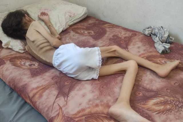 غزة.. صوت الجوع يصرخ من عظام الطفلة مريم