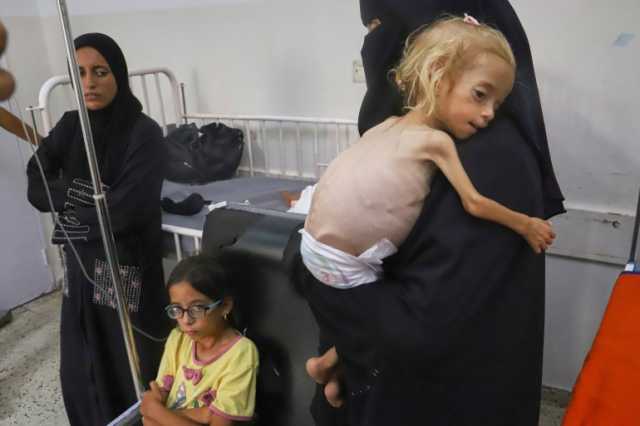 وفاة شابة من غزة جوعا بعدما وصلت إلى مستشفى في إيطاليا