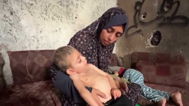 مستشفى شهداء الأقصى: المجاعة في قطاع غزة بلغت المرحلة الخامسة