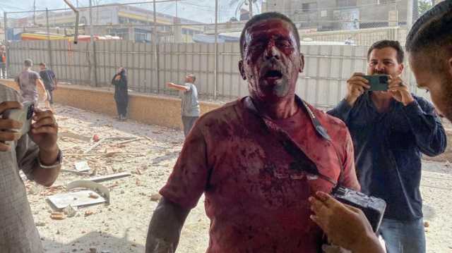 صحف: مغالطات إسرائيلية لإنكار تجويع غزة وتزايد تعاطف الأميركيين مع فلسطين