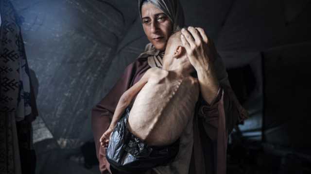 غزة تتضور جوعاً.. دفن الطفولة حيّة ونهب مستقبل فلسطين