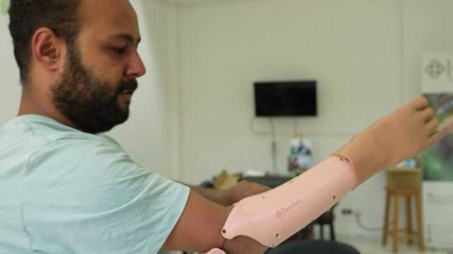 شاهد.. أطراف صناعية بالذكاء الاصطناعي والطباعة ثلاثية الأبعاد في تونس