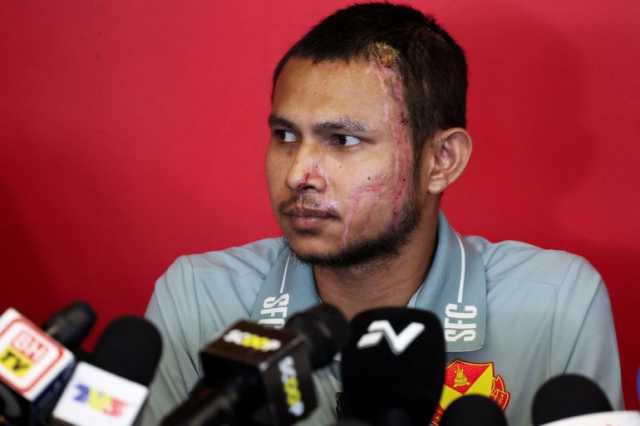 الماليزي فيصل حليم.. من ندوب الحريق إلى شجاعة لا تُقهر في كرة القدم