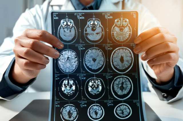 مما يسمح بابتكار تقنيات طبية آمنة.. علماء روس يبتكرون أول عدسة قادرة على تغيير شدة إشعاع التيراهرتز