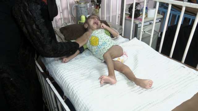 الإعلام الحكومي بغزة: إسرائيل تحرم القطاع من 350 صنفا غذائيا أساسيا