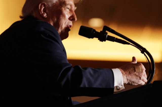 ضمادة على يد ترامب.. كيف برّرها البيت الأبيض؟