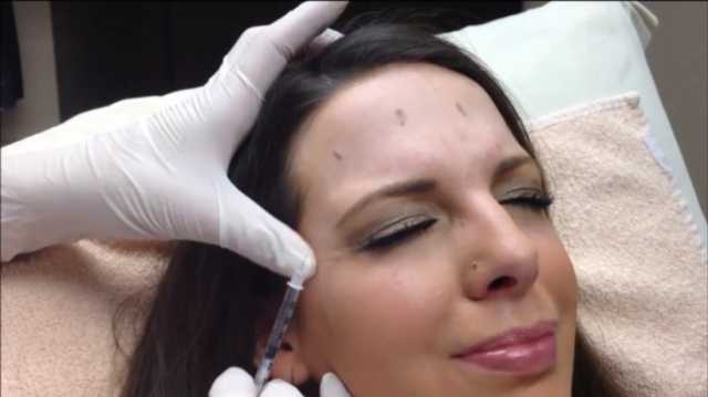 علاج صرير الأسنان ‫والصداع النصفي.. استخدامات أخرى للبوتوكس