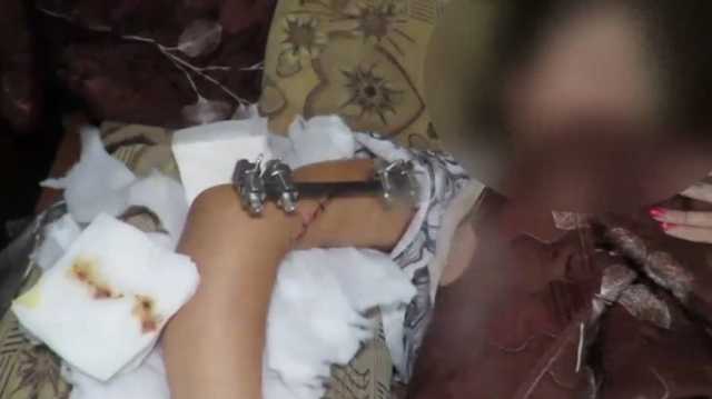 خضعت لعملية جراحية طويلة.. شاهد فيديو القسام يداوي أسيرة إسرائيلية
