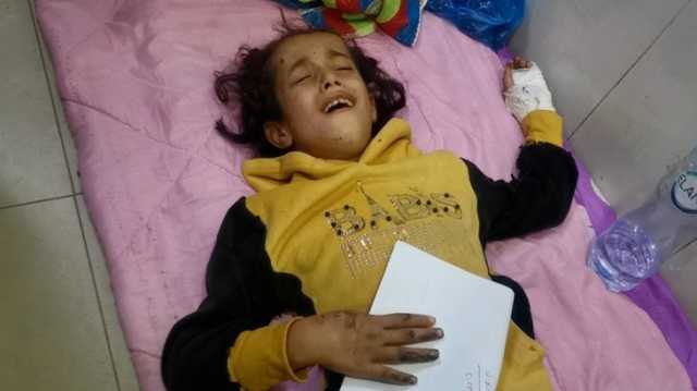 جروح متعفنة يخرج منها الدود.. شهادات للجزيرة نت عن وضع المصابين بغزة