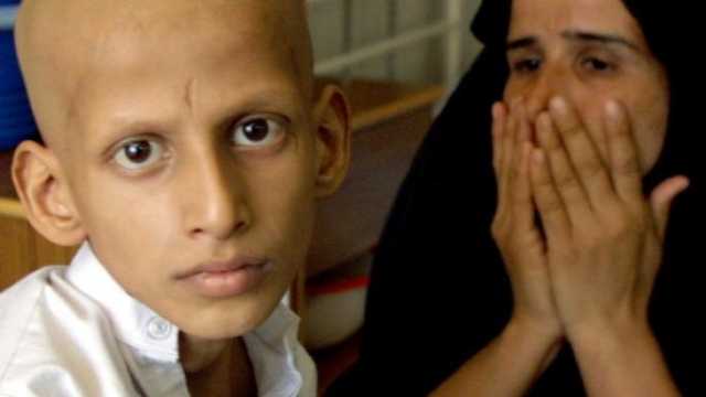 أغلبها لاطفال تحت الـ15 عامًا.. 3 أسباب تجعل السرطان يستوطن البصرة