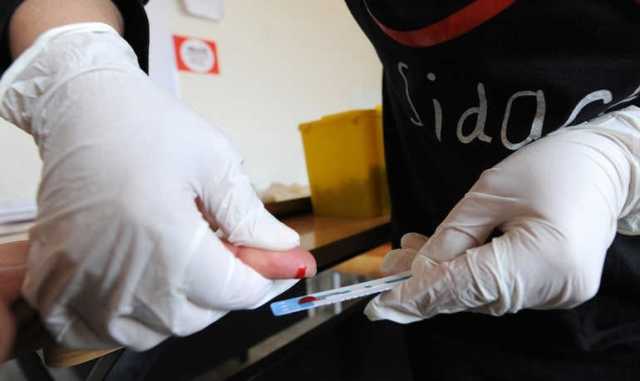هل تفشى مرض الايدز بالعراق؟.. الصحة تطمئن: هي الأقل في العالم والمنطقة- عاجل