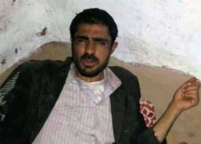 إعدام شاب يعاني من حالة نفسية في نقطة تابعة للحزام الأمني بالضالع