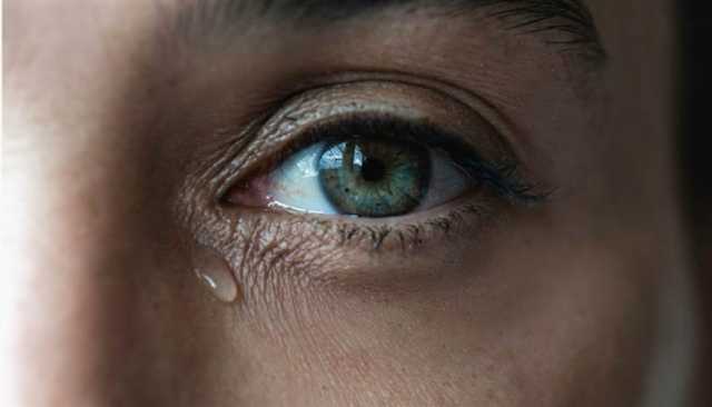 مرض غامض يحوّل دموع عشرينية إلى حِمض حارق