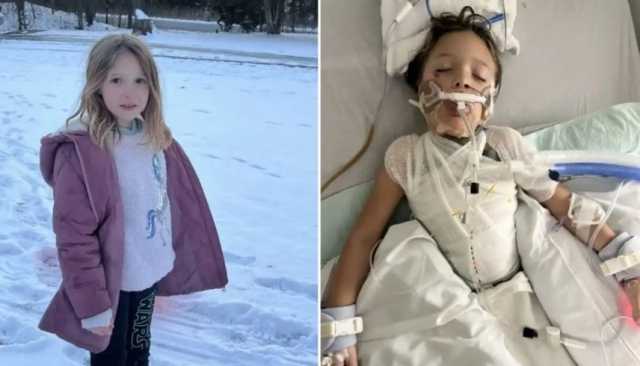 تحدٍ خطير على 'تيك توك' يصيب طفلة بحروق ويدخلها في غيبوبة