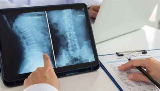 علاج جديد بالخلايا الجذعية يمنح أملاً لمرضى الشلل