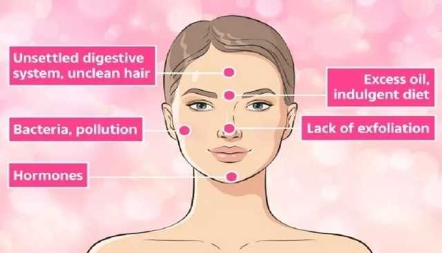ما الذي تخبره مواقع البثور في وجهك عن صحتك؟