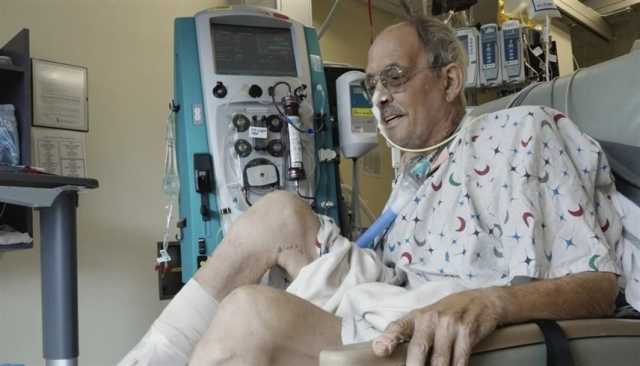 أطباء: لا مشاكل بعد شهر من حصول مريض على قلب خنزير