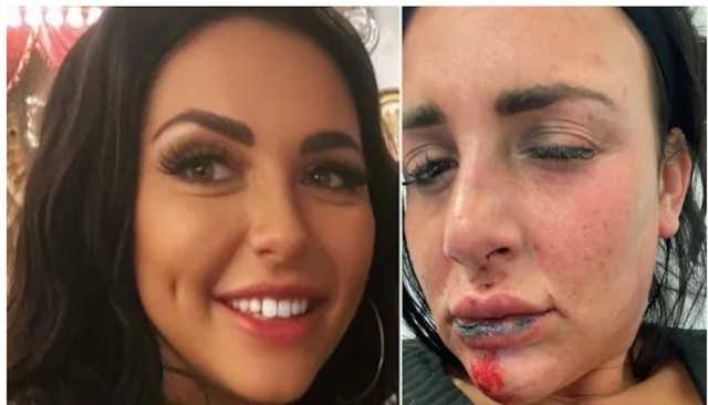 تقفز من الشرفة بسبب غيرة شريكها.. والنتيجة؟