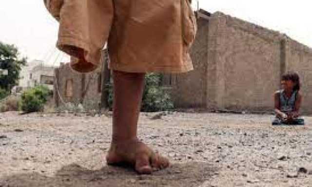 انفجار لغم في الصومعة يلحق اصابات خطيرة بالطفل وليد