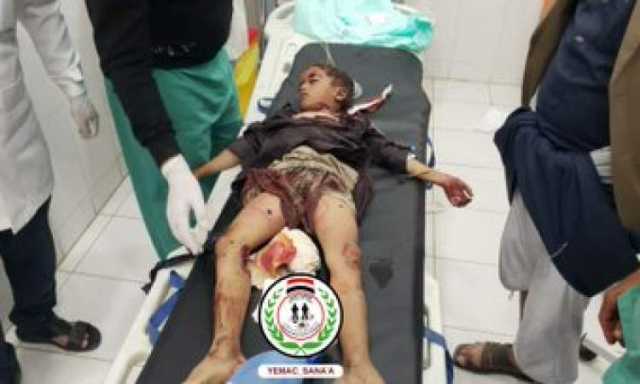 5شهداء و16جريحا بالقنابل العنقودية ومخلفات العدوان في نوفمبر
