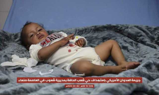 29 شهيدا ومصابا بغارات أمس على صنعاء