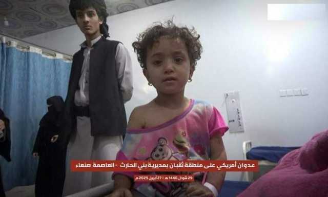 المركز اليمني لحقوق الإنسان يدين الاستهداف الأمريكي العدواني للمدنيين في اليمن