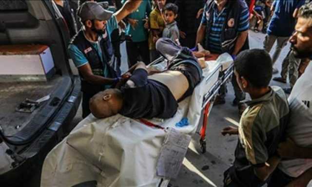 طبيب أسترالي: ضحايا مركز توزيع مساعدات برفح تلقوا رصاصات بالرأس والصدر